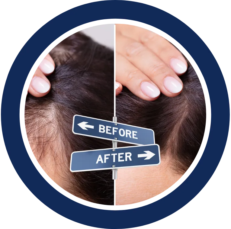 Before & After Image