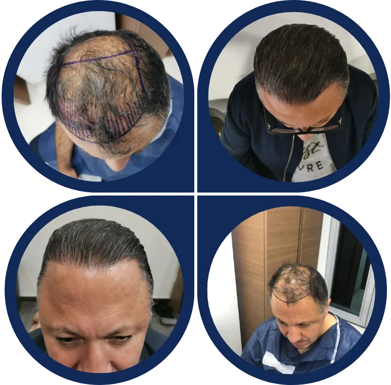 Before & After Image