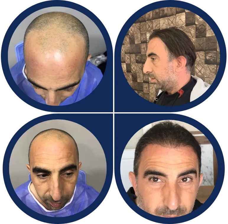 Before & After Image