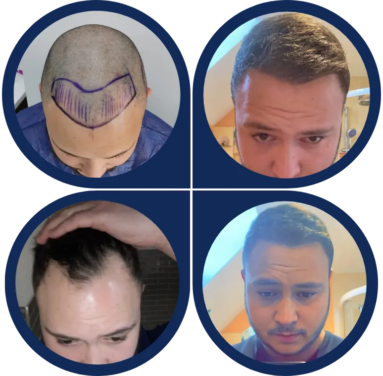 Before & After Image