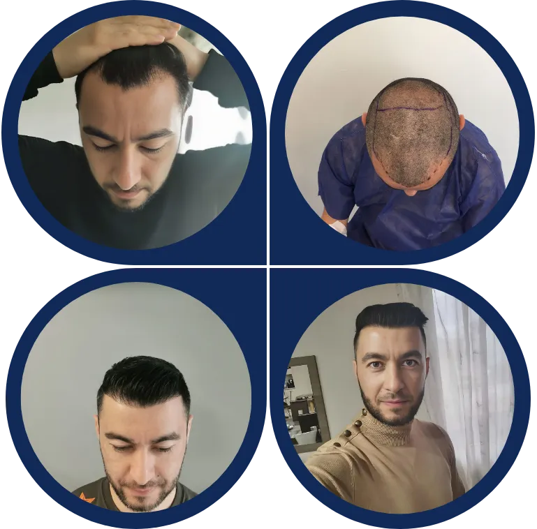 Before & After Image