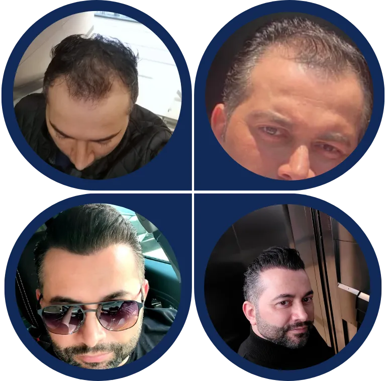 Before & After Image