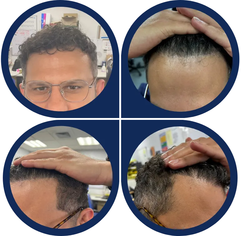 Before & After Image