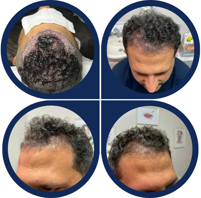 Before & After Image