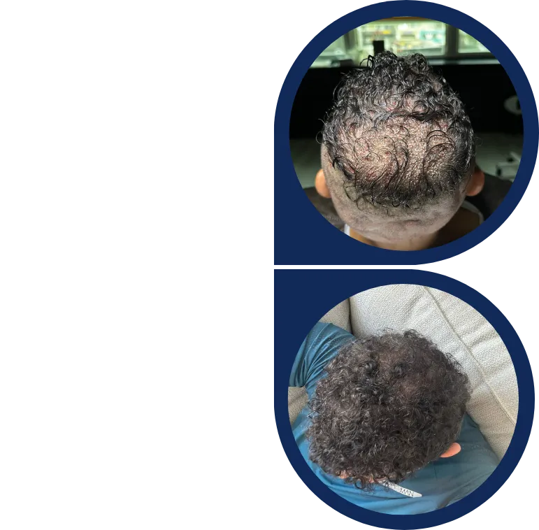 Before & After Image