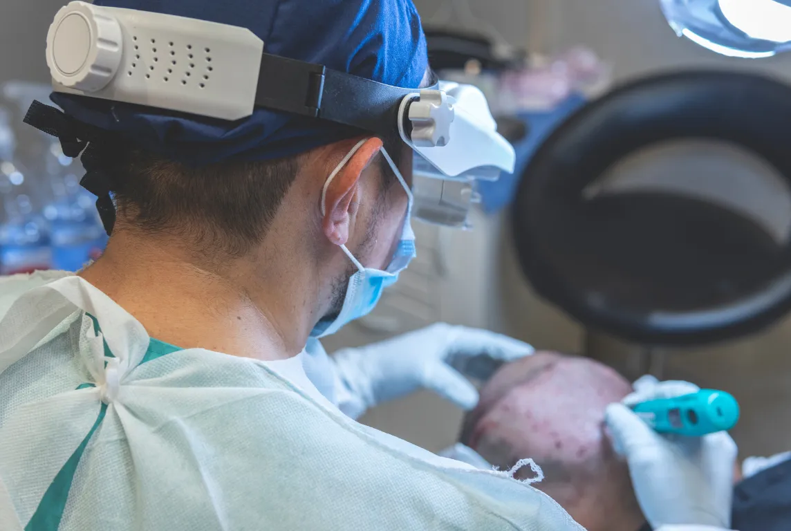 Hair Transplantation Image